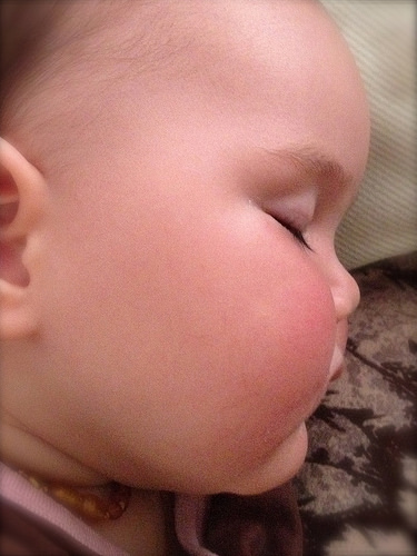 cheek cheek