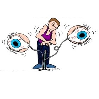 glaucoma glaucoma
