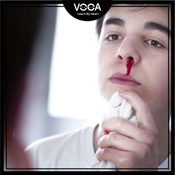 nosebleed nosebleed